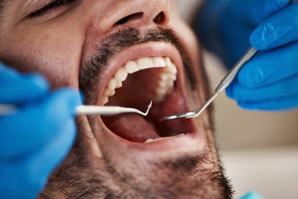 Best Pediatric Emergency Dentist in Rosend, LA