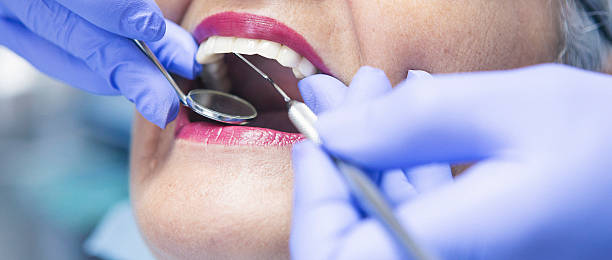 Best Emergency Tooth Extraction in Rosend, LA